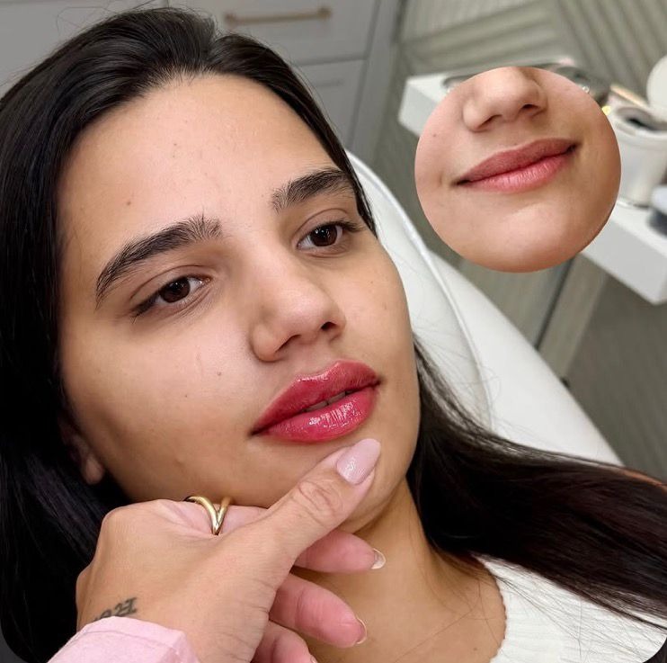 Antes e Depois